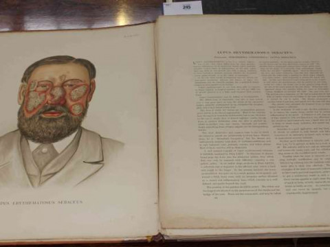 Atlas of the Diseases of the Skin, by H Radcliffe Crocker